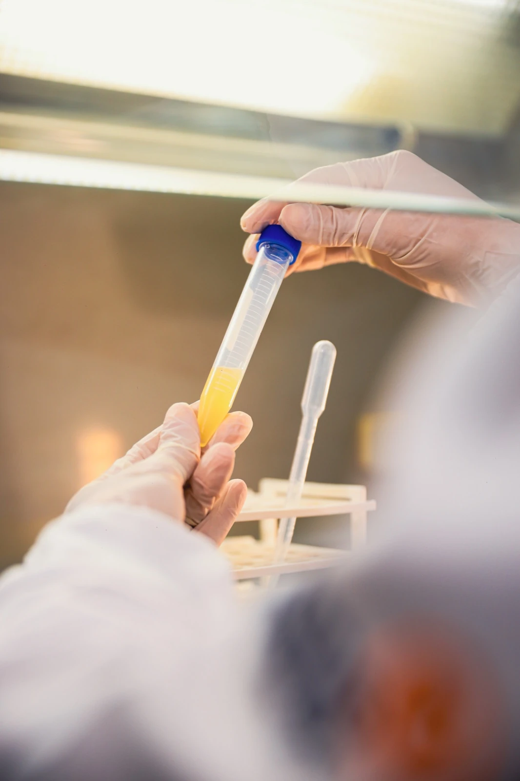 Consulta com ginecologista especializado em fertilização em Salvador